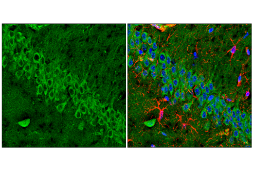Immunofluorescence Image 1: Rab7 (E9O7E) Mouse Monoclonal Antibody