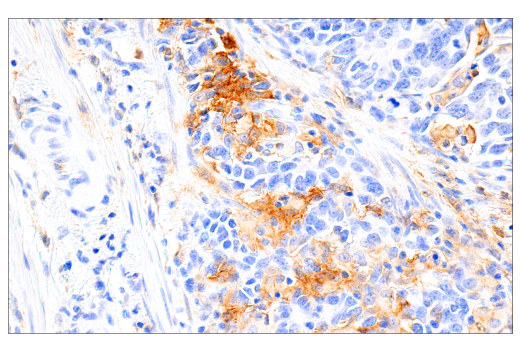 Immunohistochemistry Image 3: GM-CSF Receptor alpha (E8Z3S) Rabbit Monoclonal Antibody (BSA and Azide Free)