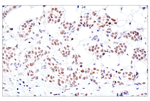 Immunohistochemistry Image 3: PMS2 (M0R4G) Mouse Monoclonal Antibody