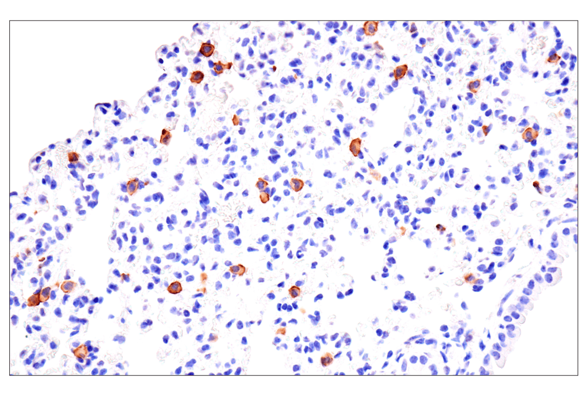 Immunohistochemistry Image 3: CD22 (F9D1W) Rabbit Monoclonal Antibody (BSA and Azide Free)