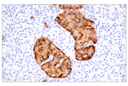 Immunohistochemistry Image 5: TIMP1 (D10E6) Rabbit Monoclonal Antibody
