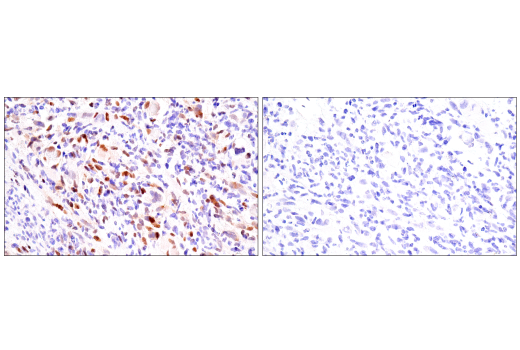 Immunohistochemistry Image 2: Myogenin (LO26) Mouse Monoclonal Antibody