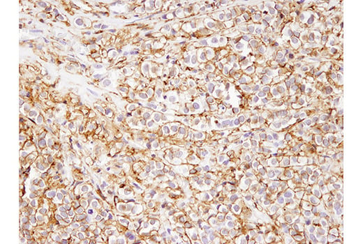 Immunohistochemistry Image 1: Phospho-Ezrin (Thr567)/Radixin (Thr564)/Moesin (Thr558) (48G2) Rabbit mAb