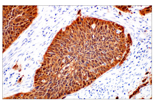 Immunohistochemistry Image 2: p16 INK4A (BC42) Mouse Monoclonal Antibody