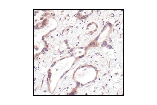 undefined Image 16: 4E-BP Antibody Sampler Kit