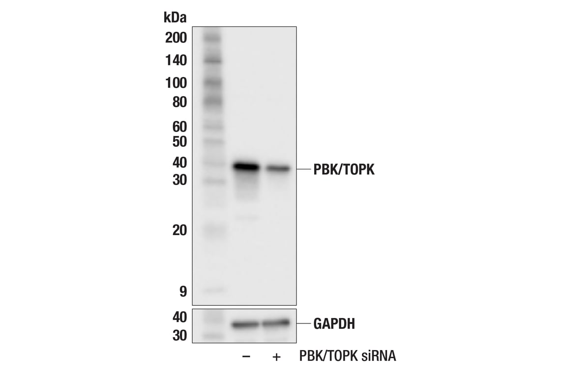 Western Blotting Image 2: PBK/TOPK (F2X2Z) Rabbit Monoclonal Antibody