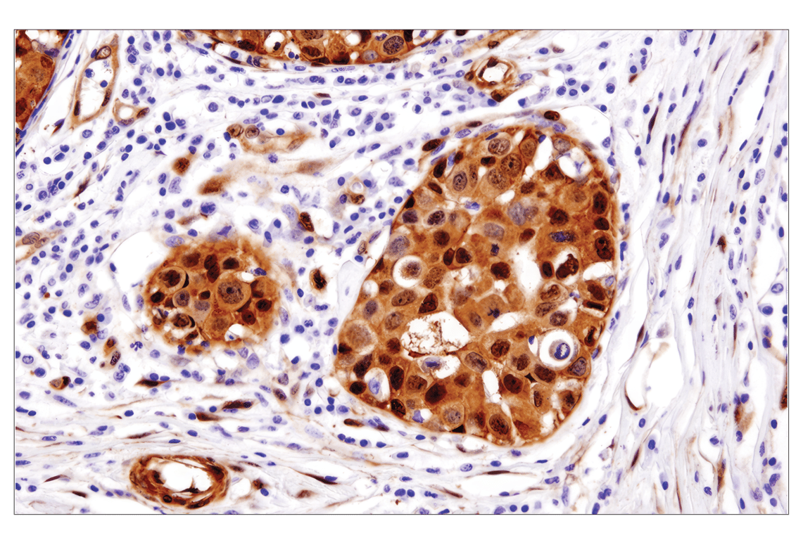 Immunohistochemistry Image 1: YAP (D8H1X) Rabbit Monoclonal Antibody