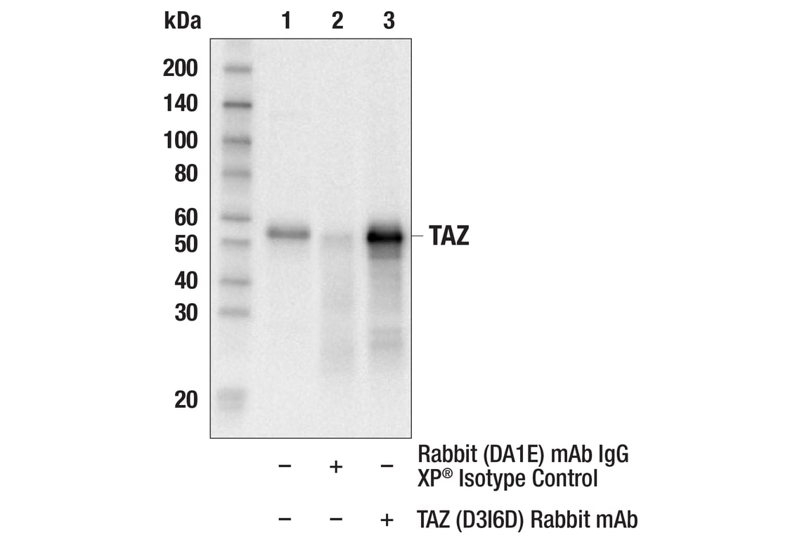 undefined Image 42: Hippo Pathway: Upstream Signaling Antibody Sampler Kit