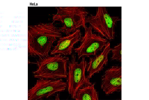 undefined Image 12: Acetyl-Histone Antibody Sampler Kit