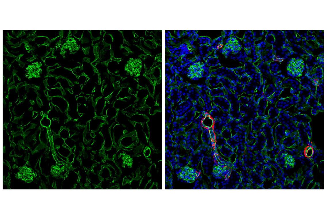 専用　cd31枚 CD31/PECAM-1 Antibody (JC/70A) - BSA Free (NB600-562) by