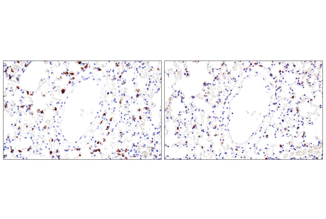 Immunohistochemistry Image 3: LAMP3/CD208 (E8T2T) Rabbit Monoclonal Antibody (BSA and Azide Free)
