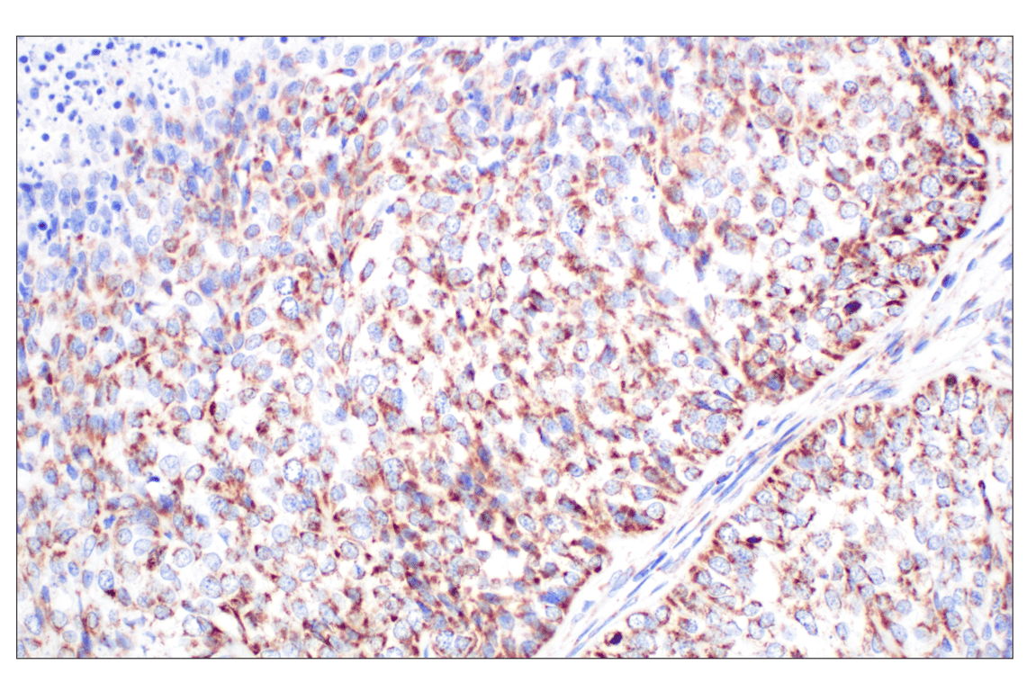 Immunohistochemistry Image 1: GCDH (F2P2M) Rabbit Monoclonal Antibody