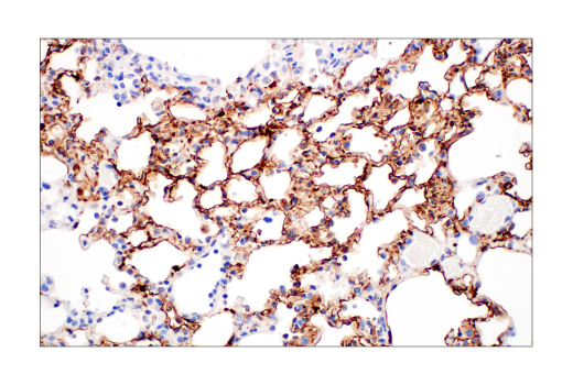 Immunohistochemistry Image 4: SARS-CoV-2 Nucleocapsid Protein (HL344) Rabbit Monoclonal Antibody