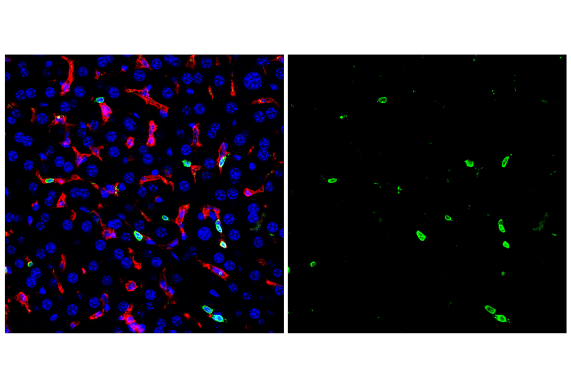Immunofluorescence Image 2: CD20 (E3N7O) Rabbit Monoclonal Antibody (BSA and Azide Free)