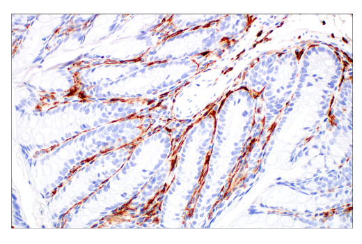 Immunohistochemistry Image 5: CD206/MRC1 (E6T5J) Rabbit Monoclonal Antibody (BSA and Azide Free)