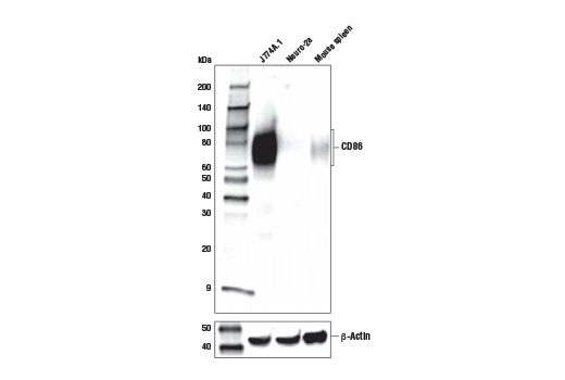 Western Blotting Image 1: CD86 (E5W6H) Rabbit mAb