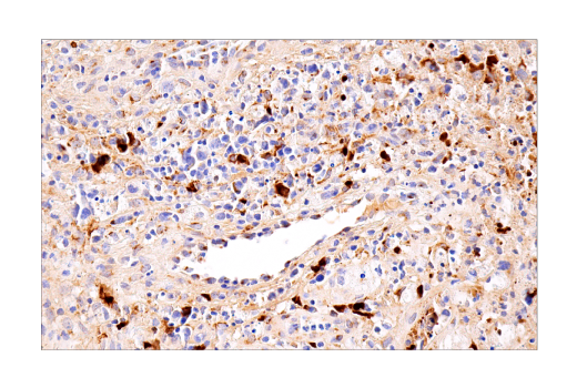 Immunohistochemistry Image 1: CXCL9/MIG (E6Z5W) Rabbit Monoclonal Antibody (BSA and Azide Free)