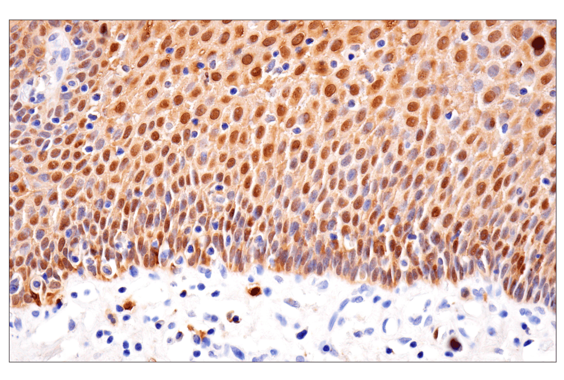 Immunohistochemistry Image 8: S100A8 (F4R2W) Rabbit Monoclonal Antibody
