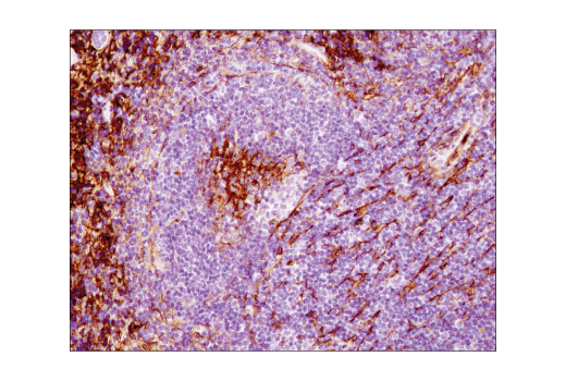 Immunohistochemistry Image 3: VCAM-1 (D2T4N) Rabbit Monoclonal Antibody