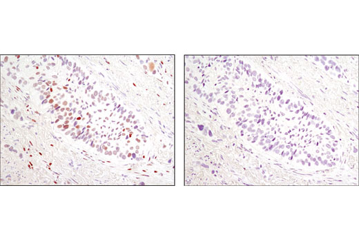 Immunohistochemistry Image 1: Phospho-c-Jun (Ser73) (D47G9) Rabbit Monoclonal Antibody (BSA and Azide Free)