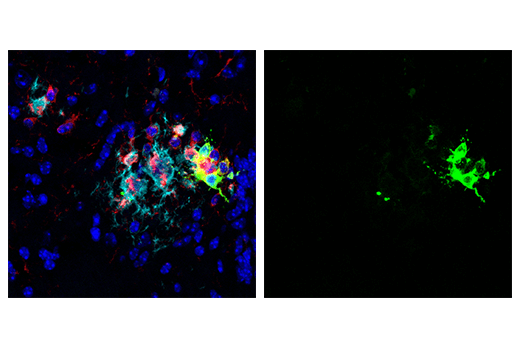 Immunofluorescence Image 1: GPNMB (E7U1Z) Rabbit Monoclonal Antibody