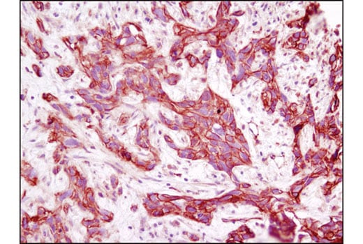 Immunohistochemistry Image 1: Annexin A2 (D11G2) Rabbit Monoclonal Antibody (BSA and Azide Free)
