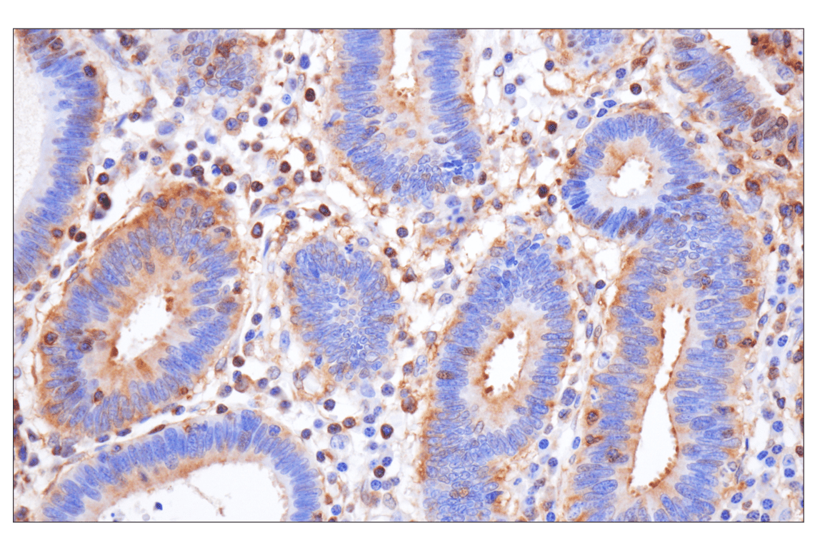 Immunohistochemistry Image 6: NF-kappaB p65 (D14E12) Rabbit Monoclonal Antibody (BSA and Azide Free)