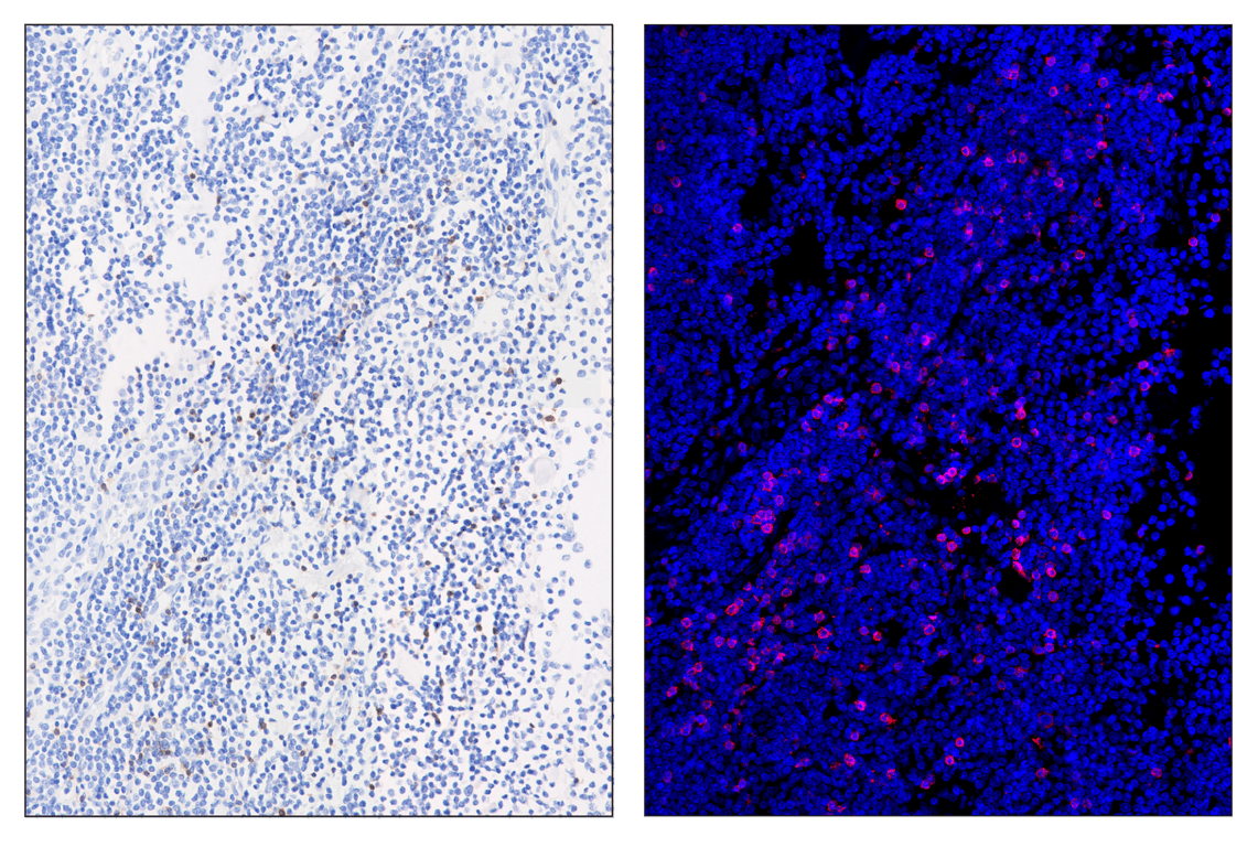Immunohistochemistry Image 3: CD23 (E1R4G) & CO-0214-488 SignalStar<sup>®</sup> Oligo-Antibody Pair