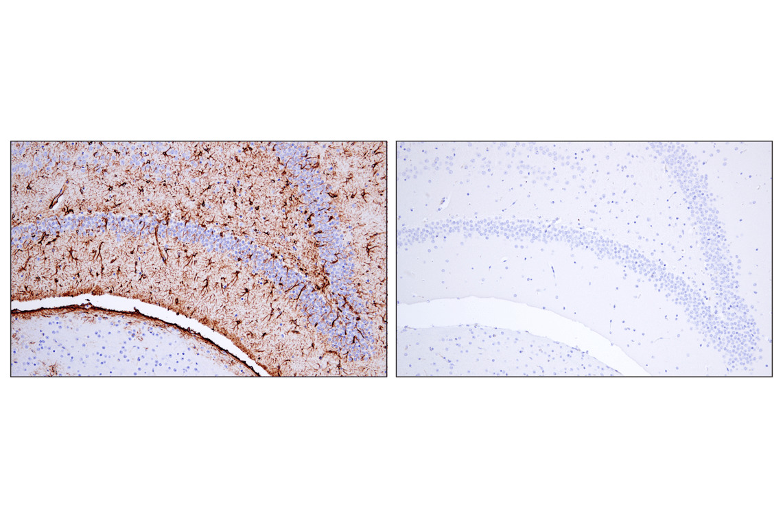 Immunohistochemistry Image 3: GFAP (E4L7M) Rabbit Monoclonal Antibody (BSA and Azide Free)