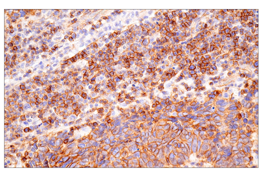 Immunohistochemistry Image 5: CD99 (PCB1) Mouse Monoclonal Antibody
