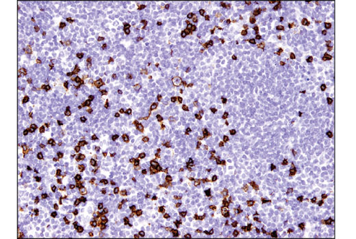 Immunohistochemistry Image 3: CD8 alpha (D8A8Y) Rabbit Monoclonal Antibody