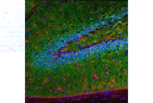 Immunofluorescence Image 1: CaMKII-alpha (6G9) Mouse Monoclonal Antibody