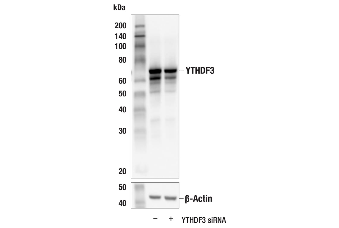 Western Blotting Image 2: YTHDF3 (E2J9I) Rabbit Monoclonal Antibody