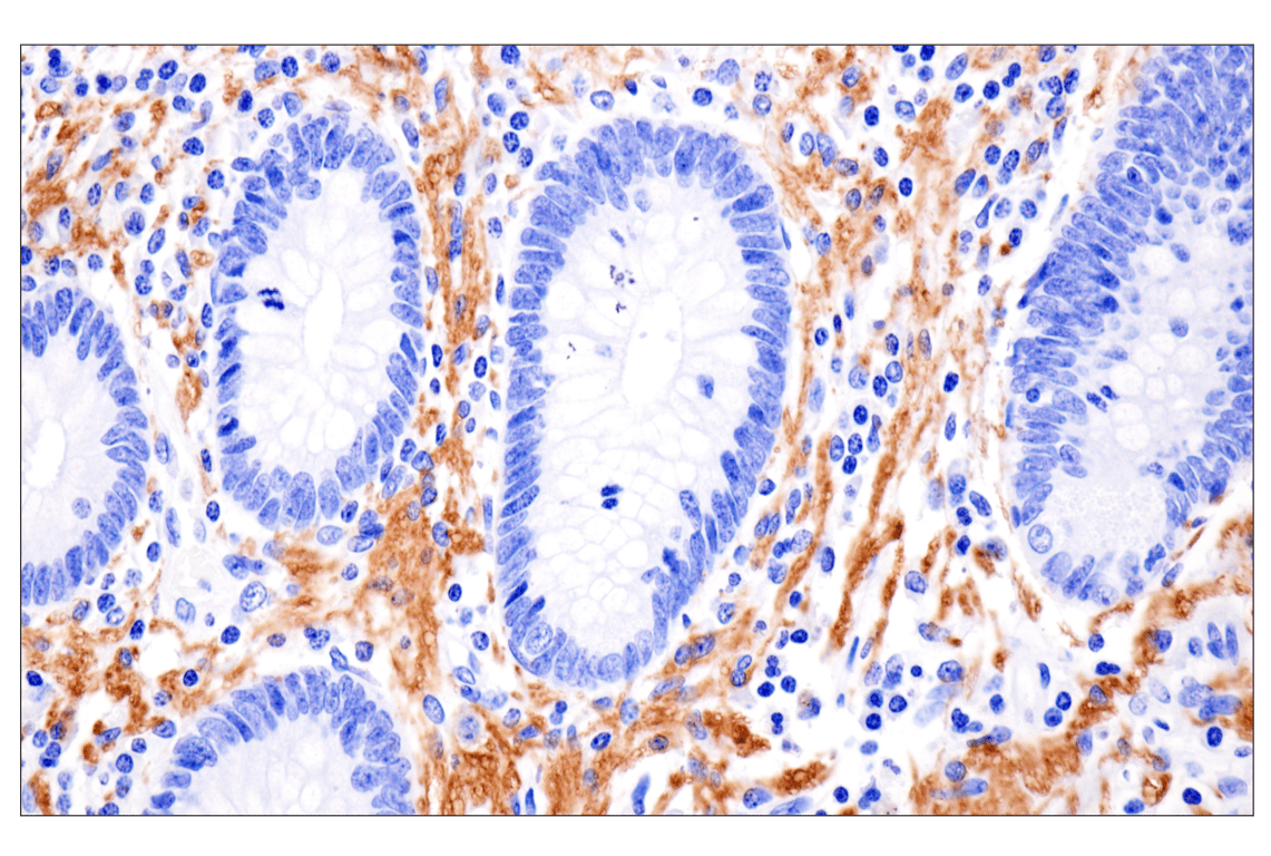 Immunohistochemistry Image 8: Phospho-Tau (Ser396) (F3S9T) Rabbit Monoclonal Antibody