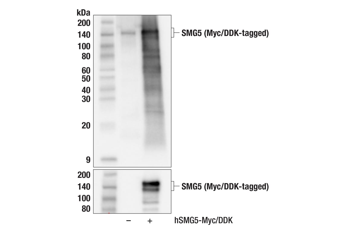 Western Blotting Image 3: SMG5 (F9P6O) Rabbit Monoclonal Antibody