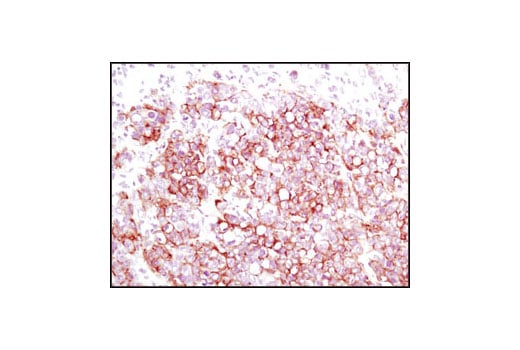 undefined Image 22: PhosphoPlus<sup>®</sup> Met (Tyr1234/Tyr1235) Antibody Duet