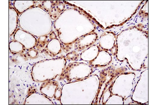 Immunohistochemistry Image 1: DEPTOR/DEPDC6 (D9F5) Rabbit Monoclonal Antibody (BSA and Azide Free)