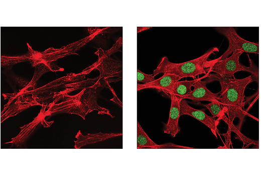 Immunofluorescence Image 1: IRF-9 (D9I5H) Rabbit Monoclonal Antibody (BSA and Azide Free)