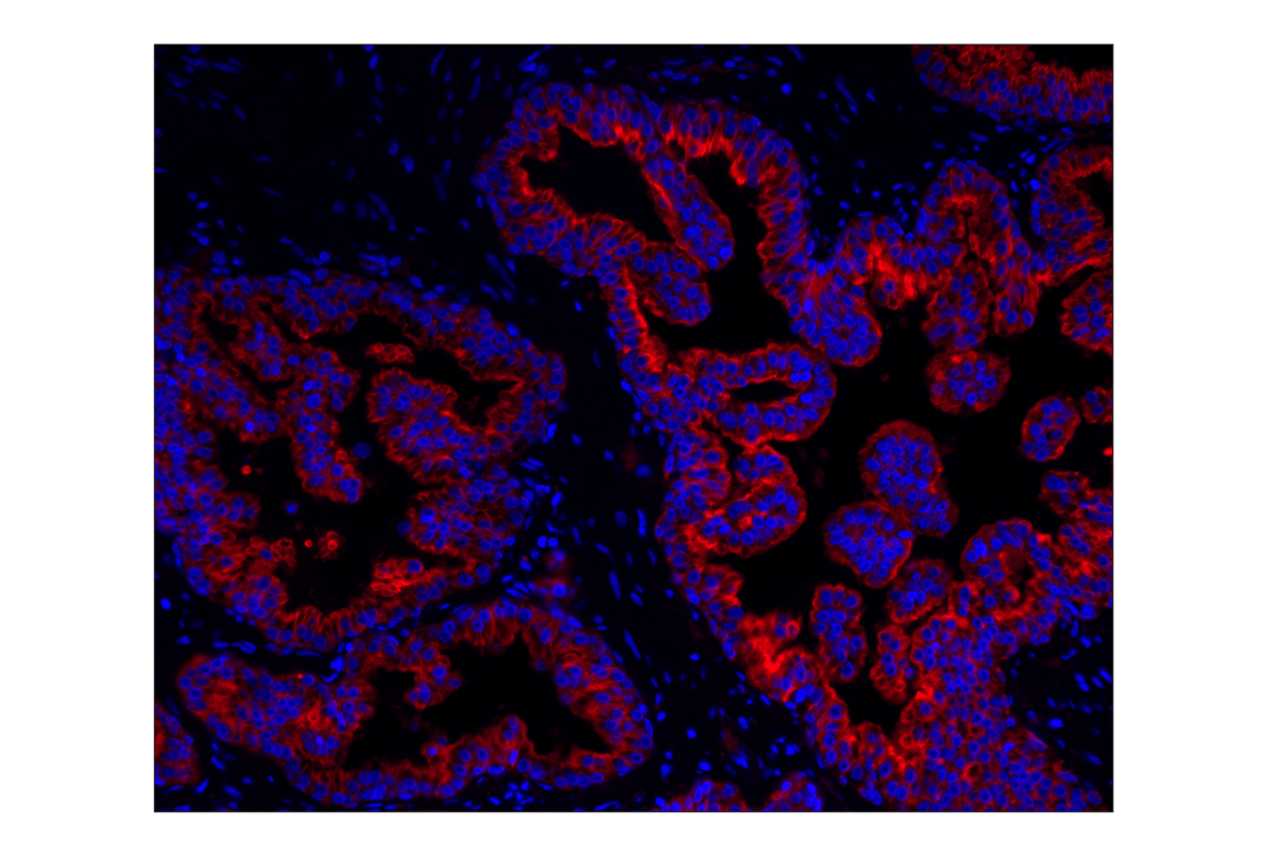 Immunohistochemistry Image 1: Pan-Keratin (C11) Mouse mAb (Alexa Fluor<sup>®</sup> 555 Conjugate)