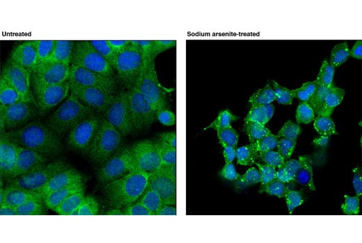 Immunofluorescence Image 1: RSK2 (D21B2) Rabbit Monoclonal Antibody