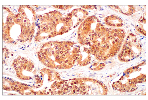 undefined Image 19: Gluconeogenesis Antibody Sampler Kit