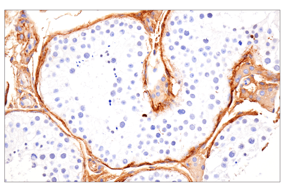Immunohistochemistry Image 12: Vitronectin (F8D3L) Rabbit Monoclonal Antibody