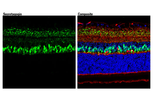 Immunofluorescence Image 1: Secretagogin (D4V1Y) Rabbit Monoclonal Antibody
