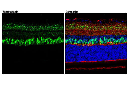 Immunofluorescence Image 1: Secretagogin (D4V1Y) XP<sup>®</sup> Rabbit mAb