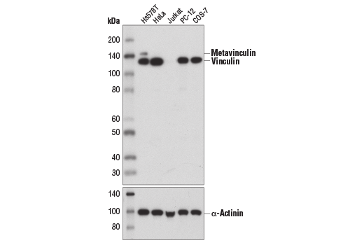 Western Blotting Image 1: Vinculin (E1E9V) XP<sup>®</sup> Rabbit mAb (BSA and Azide Free)