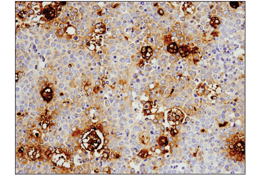 Immunohistochemistry Image 2: Legumain (D6S4H) Rabbit Monoclonal Antibody (BSA and Azide Free)