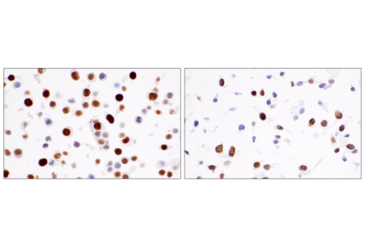 Immunohistochemistry Image 9: ATAD2 (E8Y7F) Rabbit Monoclonal Antibody