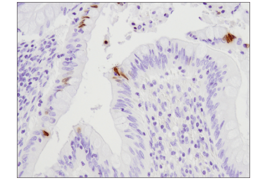 Immunohistochemistry Image 2: Phospho-Histone H2A.X (Ser139) (D7T2V) Mouse Monoclonal Antibody