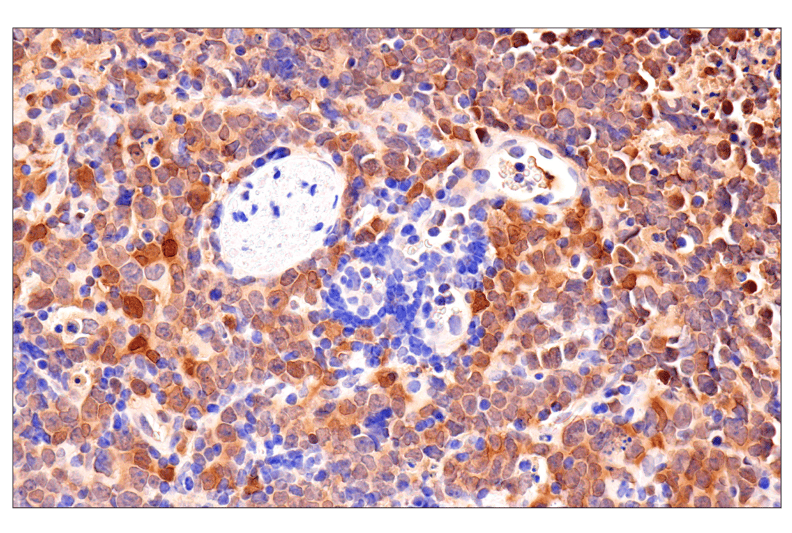 Immunohistochemistry Image 7: CDK6 (E3E3Q) Rabbit Monoclonal Antibody (BSA and Azide Free)