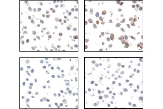 Immunohistochemistry Image 2: Phospho-HER2/ErbB2 (Tyr1221/1222) (6B12) Rabbit Monoclonal Antibody (BSA and Azide Free)
